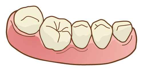 親知らずを抜かずに残していい場合の特徴