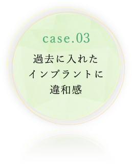 過去に入れたインプラントに違和感